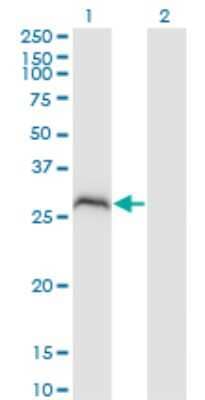 Western Blot: PPP1R2P3 Antibody (1H2) [H00153743-M02]