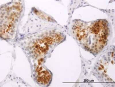 Immunohistochemistry-Paraffin: PPP1R2P3 Antibody (2G11) [H00153743-M01]