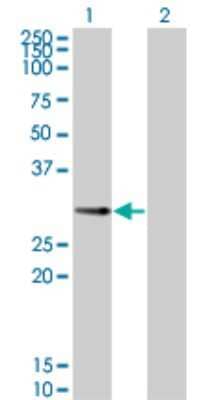 Western Blot: PPP1R2P3 Antibody (2G11) [H00153743-M01]