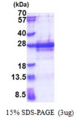 SDS-PAGE: Recombinant Human PP1 Inhibitor-2 His Protein [NBP2-23380]