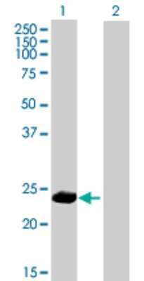 Western Blot: PPP1R2P9 Antibody [H00080316-B01P]