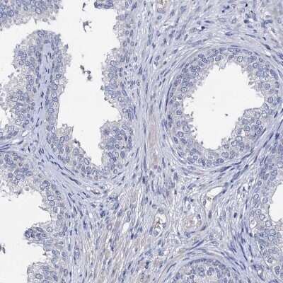 Immunohistochemistry-Paraffin: PPP1R32 Antibody [NBP1-93873]