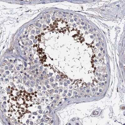 Immunohistochemistry-Paraffin: PPP1R32 Antibody [NBP1-93873]
