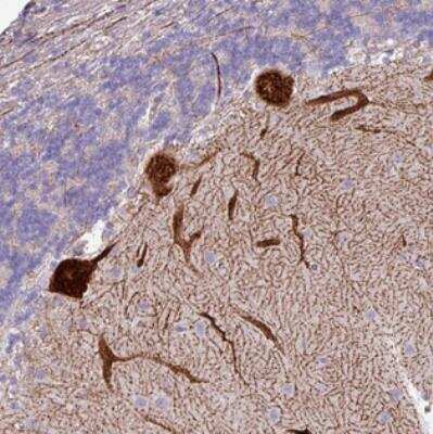Immunohistochemistry: PPP1R35 Antibody [NBP2-30996]