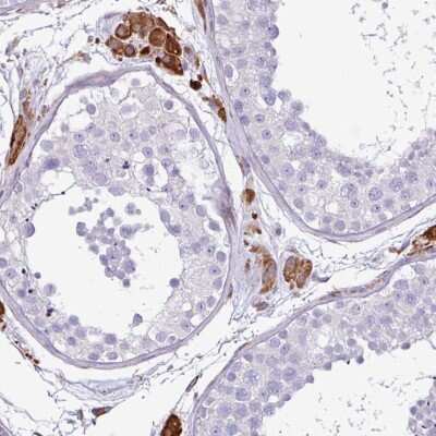 Immunohistochemistry-Paraffin: PPP1R35 Antibody [NBP2-30996]