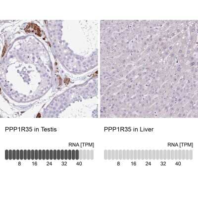 Immunohistochemistry-Paraffin: PPP1R35 Antibody [NBP2-30996]