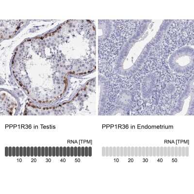 Immunohistochemistry-Paraffin: PPP1R36 Antibody [NBP2-62718]