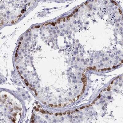 Immunohistochemistry-Paraffin: PPP1R36 Antibody [NBP2-62718]
