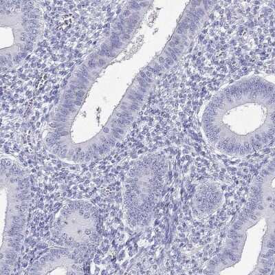 Immunohistochemistry-Paraffin: PPP1R36 Antibody [NBP2-62718]