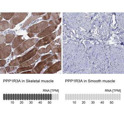 Immunohistochemistry-Paraffin: PPP1R3A Antibody [NBP3-17131]