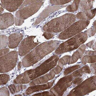 Immunohistochemistry-Paraffin: PPP1R3A Antibody [NBP3-17131]