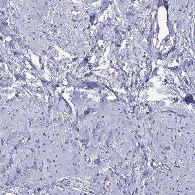 Immunohistochemistry-Paraffin: PPP1R3A Antibody [NBP3-17131]