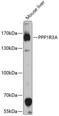 Western Blot: PPP1R3A AntibodyBSA Free [NBP3-05174]