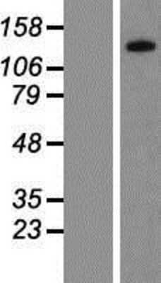 Western Blot: PPP1R3A Overexpression Lysate [NBP2-08079]