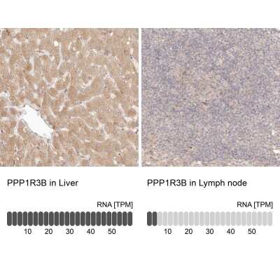 Immunohistochemistry-Paraffin: PPP1R3B Antibody [NBP1-82243]