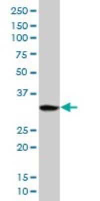 Western Blot: PPP1R3B Antibody [H00079660-B01P]