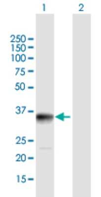 Western Blot: PPP1R3B Antibody [H00079660-B01P]