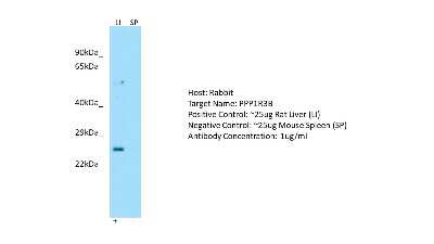 Western Blot: PPP1R3B Antibody [NBP1-79917]