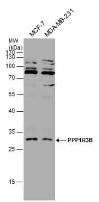 Western Blot: PPP1R3B Antibody [NBP3-12993]