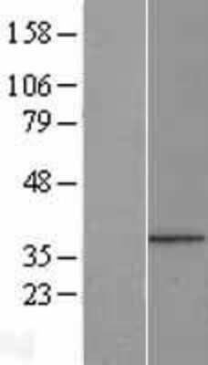 Western Blot: PPP1R3B Overexpression Lysate [NBL1-14683]