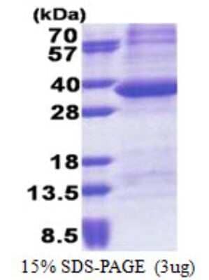 SDS-PAGE: Recombinant Human PPP1R3B His Protein [NBP2-23381]