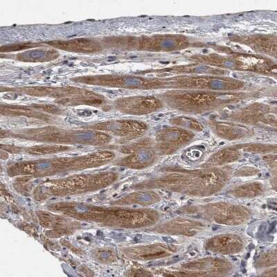 Immunohistochemistry-Paraffin: PPP1R3C Antibody [NBP1-87236]