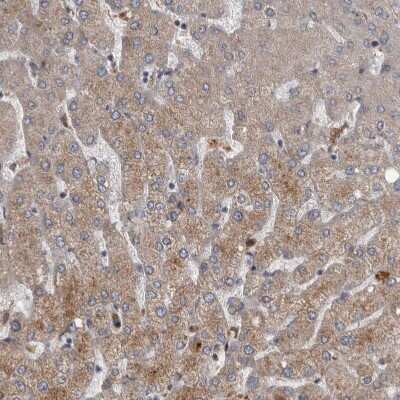 Immunohistochemistry-Paraffin: PPP1R3C Antibody [NBP1-87236]