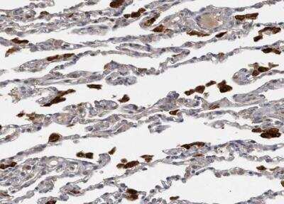 Immunohistochemistry-Paraffin: PPP1R3C Antibody [NBP1-87236]