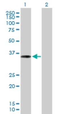 Western Blot: PPP1R3C Antibody [H00005507-B02P]