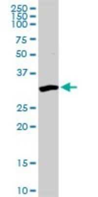 Western Blot: PPP1R3C Antibody [H00005507-D03P]