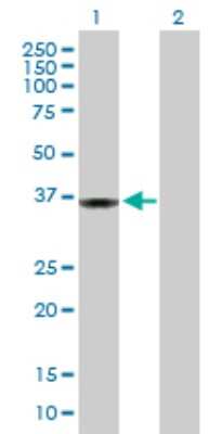 Western Blot: PPP1R3C Antibody [H00005507-D03P]