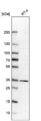 Western Blot: PPP1R3C Antibody [NBP1-87236]