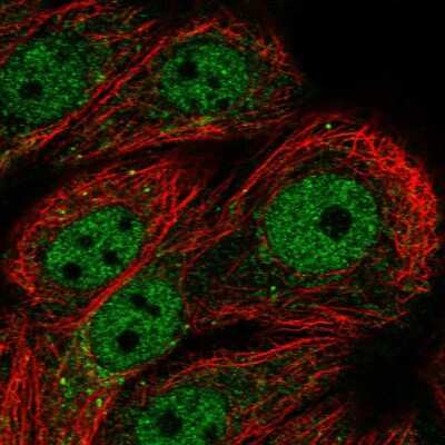 Immunocytochemistry/ Immunofluorescence: PPP1R3F Antibody [NBP2-55111]