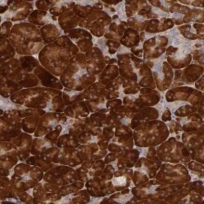 Immunohistochemistry-Paraffin: PPP1R3F Antibody [NBP1-93703]