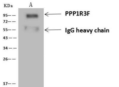 Immunoprecipitation: PPP1R3F Antibody [NBP3-12626]