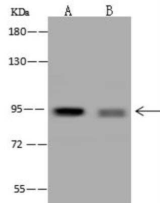 Western Blot: PPP1R3F Antibody [NBP3-12626]