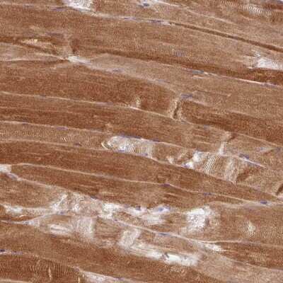 Immunohistochemistry-Paraffin: PPP1R3G Antibody [NBP2-34170]