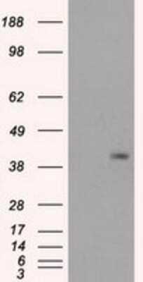 Western Blot: PPP1R7 Antibody (OTI4F9) [NBP1-47924]