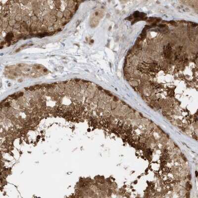 Immunohistochemistry: PPP1R7 Antibody [NBP2-38207]