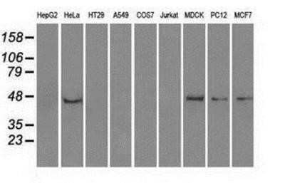 Western Blot: PPP1R7 Antibody (OTI4F9)Azide and BSA Free [NBP2-73586]