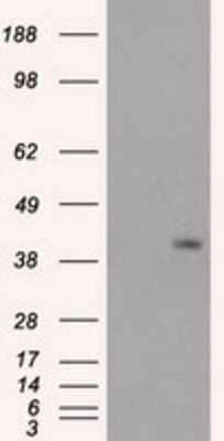 Western Blot: PPP1R7 Antibody (OTI4F9)Azide and BSA Free [NBP2-73586]