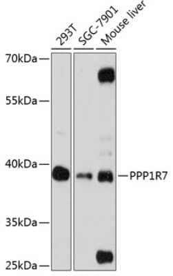 Western Blot: PPP1R7 AntibodyAzide and BSA Free [NBP2-94215]