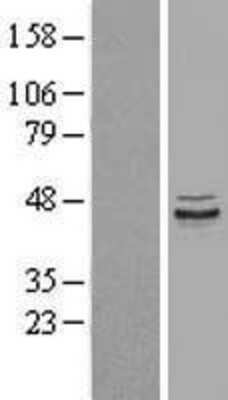 Western Blot: PPP1R7 Overexpression Lysate [NBL1-14685]