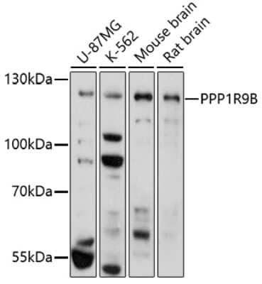 Western Blot: PPP1R9B/Spinophilin AntibodyAzide and BSA Free [NBP2-93196]