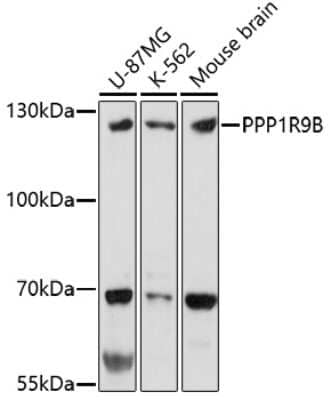 Western Blot: PPP1R9B/Spinophilin AntibodyAzide and BSA Free [NBP2-94055]