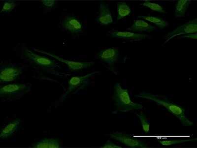 Immunocytochemistry/ Immunofluorescence: PPP2CB Antibody [H00005516-B01P]