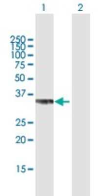 Western Blot: PPP2CB Antibody [H00005516-B01P]