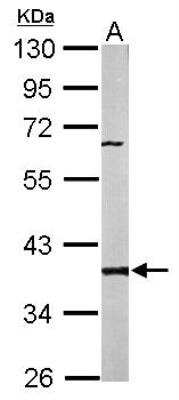 Western Blot: PPP2CB Antibody [NBP1-32069]