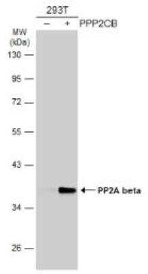 Western Blot: PPP2CB Antibody [NBP1-32069]