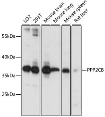 Western Blot: PPP2CB AntibodyAzide and BSA Free [NBP2-94074]